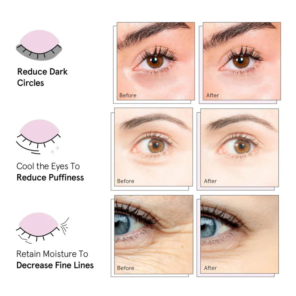 Microneedle Peptide Patches