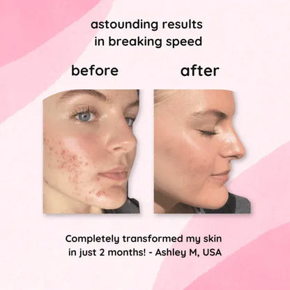 Turmeric Kojic Acid Pads | Naturally Clear, Glowing Skin
